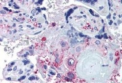 ADAMTS5 Antibody, Novus Biologicals 50 &mu;g; Unconjugated:Antibodies,